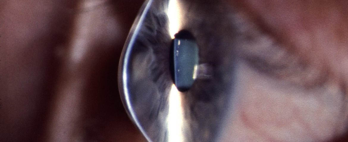 Prof. Dr. Fehmi Cem Küçükerdönmez, Retina Hastalıkları ve Retina Cerrahisi - İzmir Göz Doktoru