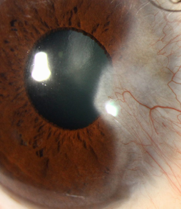 Prof. Dr. Fehmi Cem Küçükerdönmez, Retina Hastalıkları ve Retina Cerrahisi - İzmir Göz Doktoru